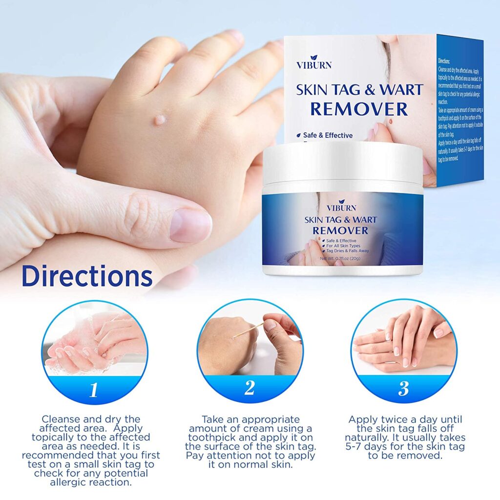 Skin Tag Remover, Warts & Mole Remover Cream- Best Skin Tag Removal ...