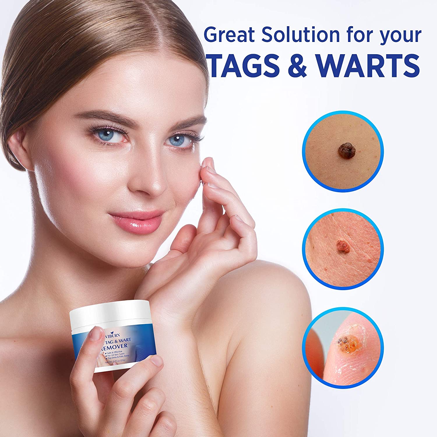 Skin Tag Remover, Warts & Mole Remover Cream- Best Skin Tag Removal ...